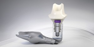 implant