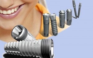 دستورات پس از ایمپلنت