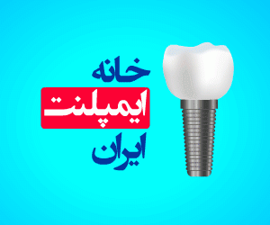 خانه ایمپلنت ایران