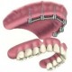 Replacing all teeth with a removable prosthesis