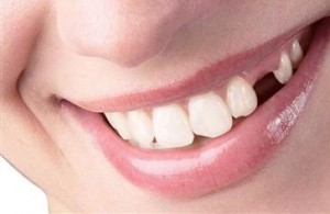 حفظ فضای خلفی