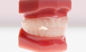 Choosing your new artificial teeth