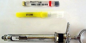 Local Anesthesia