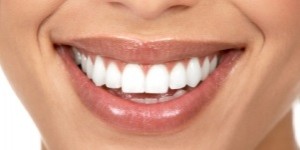 A description of the maxillary implant