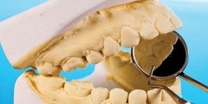 A description of the maxillary
