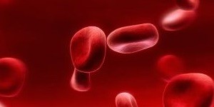 خونریزی تهدید کننده حیات در ایمپلنت