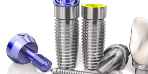 جایگذاری ایمپلنت