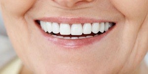 ایمپلنت های دندانی برای چه کسانی مؤثر است؟