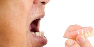 آماری از بی دندانی کامل