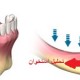 طرح درمان و بررسی تحلیل استخوان بیمار جهت ایمپلنت