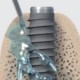 Dental Implant Maintenance