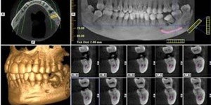 توموگرافی کامپیوتری و کاربرد سی تی اسکن