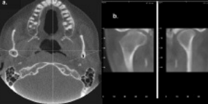 Clinical Applications of Cone-Beam Computed Tomography in Dental Practice
