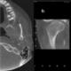 Clinical Applications of Cone-Beam Computed Tomography in Dental Practice