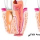 Dental Abscess Overview