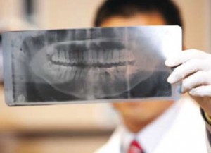 Dental X-Rays