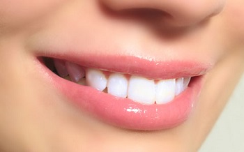 ایمپلنت های دندانی چیست؟