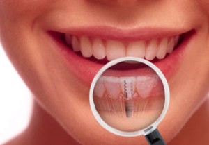 ارتباط بین سلامت دهان و بیماری های جسمی