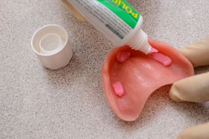 چسب پروتز دندان : کرمی