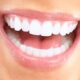 مقاومت ایمپلنت دندان در مقایسه با دندان های طبیعی