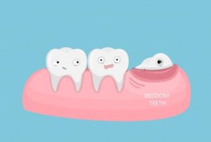 چرا توصیه میشه دندان عقل رو بکشید؟