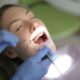 ایمپلنت دندان بدون درد | دردناک بودن ایمپلنت دندان