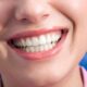 مزایای ایملپنت های دندان به طور روزمره 