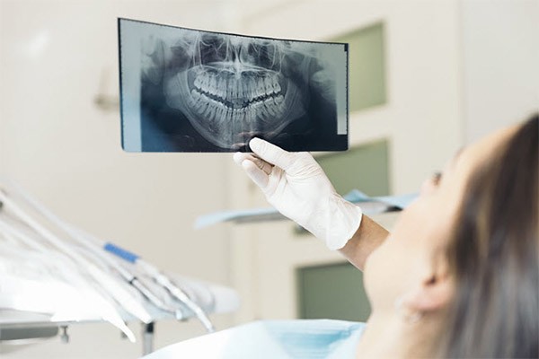 دندانپزشکی ایمپلنت