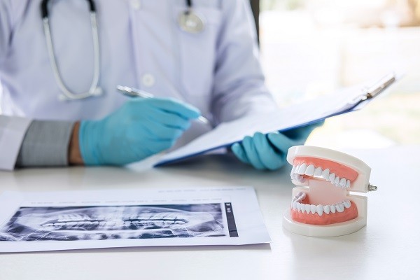 کاشت ایمپلنت دندان در مطب متخصص ایمپلنت