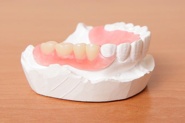 پروتزها یا دندان مصنوعی جزئی، کامل و ایمپلنت