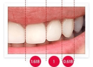 2 روش دندانپزشکی زیبایی که نباید از دست دهید!