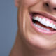 2 روش دندانپزشکی زیبایی که نباید از دست دهید!